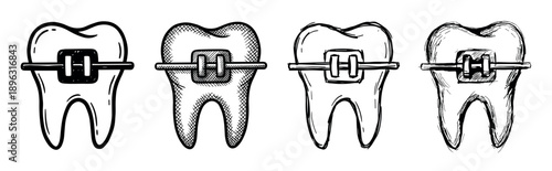 Four hand-drawn molar teeth with metal braces and archwires, a collection of black and white sketch illustrations for orthodontic treatment and dental health concepts