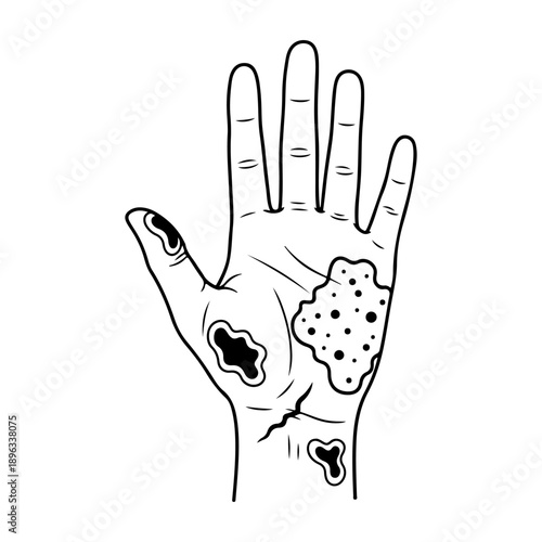 Hand illustration depicting skin conditions and dermatological issues