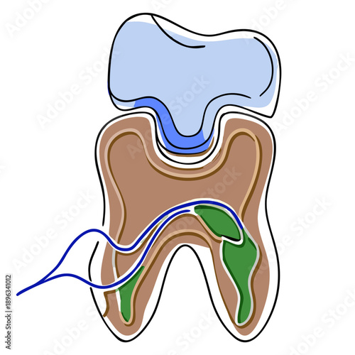 Dental tooth anatomy illustration with roots and fillings  
