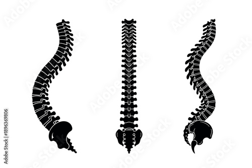 Three black silhouette spinal columns on for medical or educational use in anatomy studies