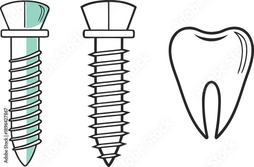 Medical Implant Design Illustration. Dental Implant Design Concept. Surgical Implant Medical Illustration. Orthopedic Implant Design Illustration. Healthcare Implant Medical Design. Modern Medical Imp