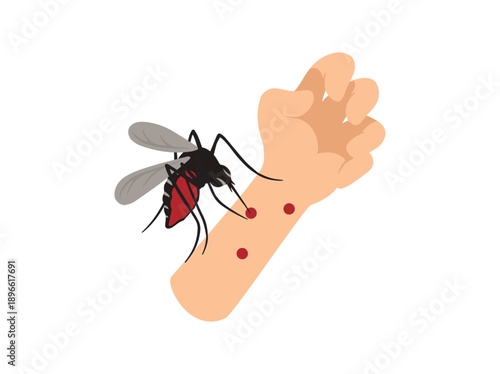 Hand Drawn Mosquito Bite in Hand Skin
