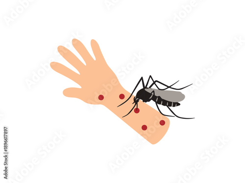 Mosquito Bite in Hand Skin Illustration
