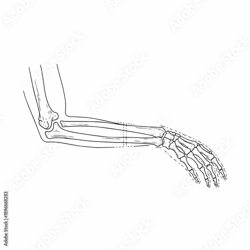 Human Arm Skeleton Diagram