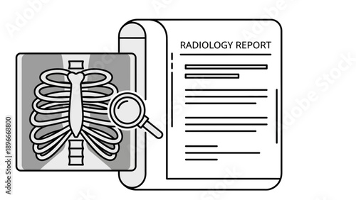 Radiology Report with Chest X-ray and Magnifying Glass Icon