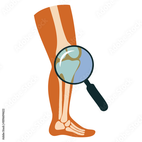 Flat vector knee pain icon representing joint disease body doctor medical care ideal for healthcare orthopedics pain management and rehabilitation related visuals
