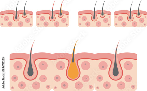 Anatomy of human hair follicle and skin layers diagram with dental decay stages and professional nail shapes chart for education