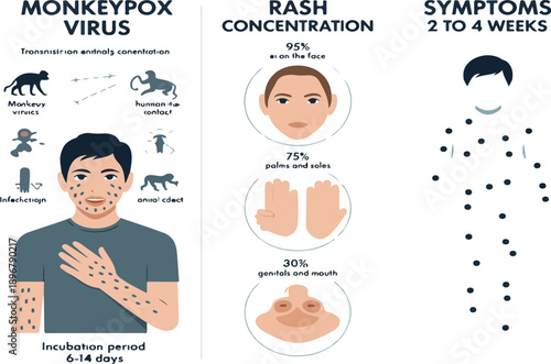 Monkeypox Virus Outline Manual Design Set – Infection, Symptoms, and Prevention