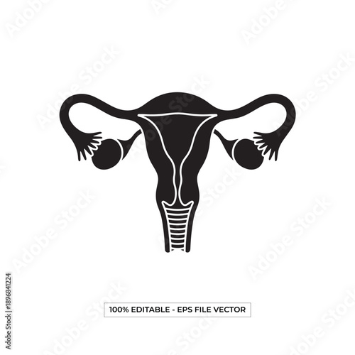 Illustration of a uterus with fallopian tubes and ovaries in a medical diagram vector format