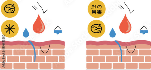 Comparison diagram of normal and damaged skin barrier showing hydration levels allergens penetration and moisture loss in human skin tissue layers