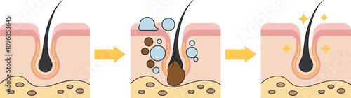 Comparison diagram of normal and damaged skin barrier showing hydration levels allergens penetration moisture loss and scalp pore cleansing process