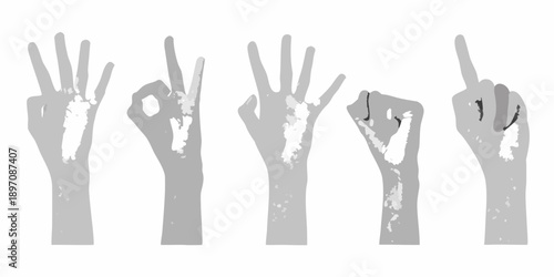 Five grayscale hands displaying different finger gestures and signs