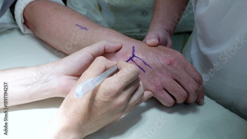 Russia Tomsk 05.07.2025: Surgical site preparation, Preparing patient for wrist operation, Clinician readying wrist area with care and precision, Ensuring sterile environment and patient