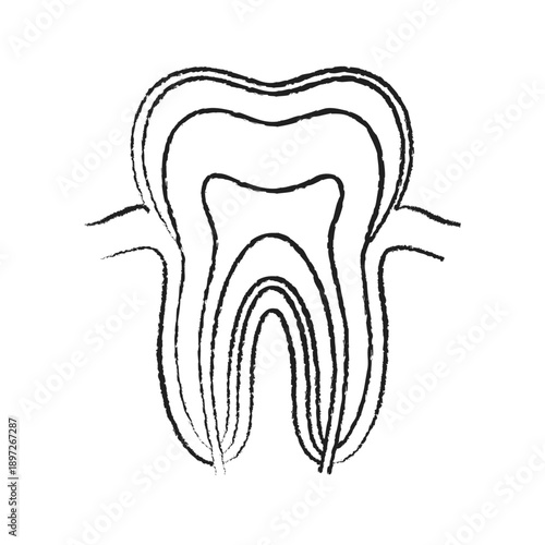 Human Tooth Anatomy Pencil Sketch Medical Illustration