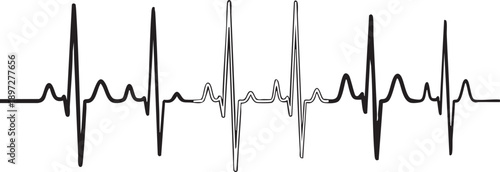 Black and white electrocardiogram waveform with alternating thick and thin lines on a white