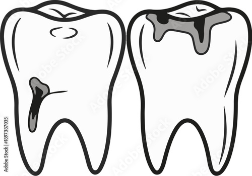 Two stylized molar teeth; one with a small cavity, the other showing extensive decay and damage