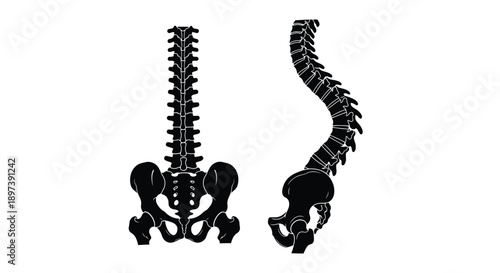 Human spine illustration showing normal and scoliosis curvature