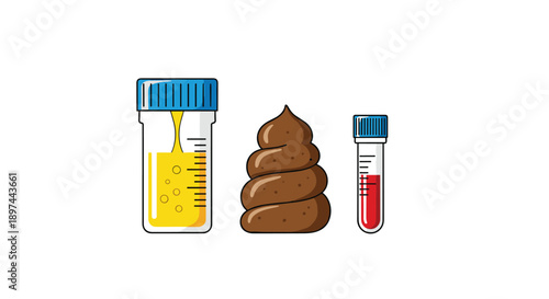Set of medical analysis samples including urine, stool, and blood in containers for laboratory testing and diagnosis.
