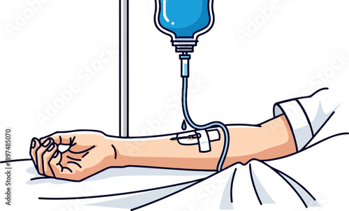 Patient's arm receiving an IV drip from a bag hanging on a stand