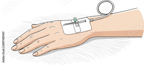 Close-up of a hand with an IV drip inserted into the wrist, set against a textured white background