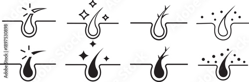 Hair Follicle Icons: A series of sleek, minimalistic icons illustrate various stages of hair growth and condition, perfect for health, beauty, and dermatological concepts.