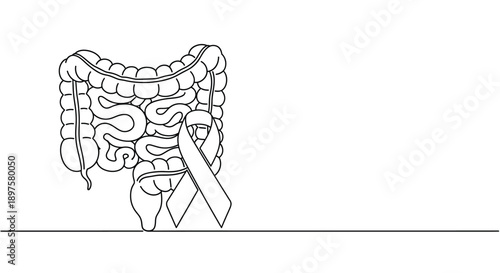The colon organ outline features a cancer awareness ribbon.
