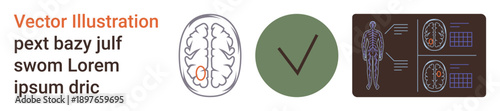 Brain diagnostics, neural health, conceptual medicine, imaging technology, human anatomy, neuroscience. Brain outline with highlighted area, checkmark icon and medical imaging screens. Brain