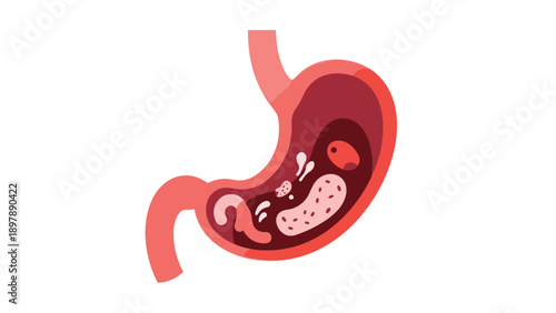 Detailed anatomical illustration of a human stomach showing internal structure, gastric pits, and digestive components.