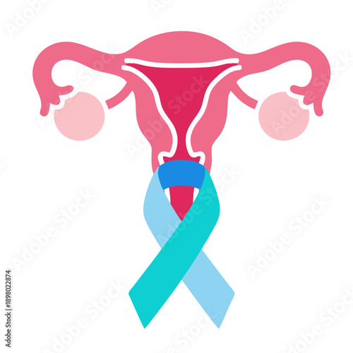 Ovarian Cancer Awareness Illustration: Female Reproductive System with Support Ribbon