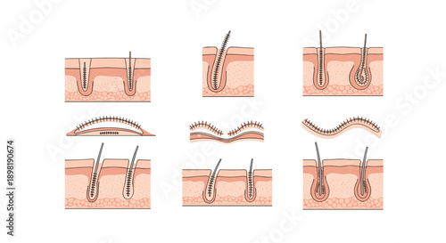 Scientific illustration showing various stages of hair growth and detailed anatomical structure of the human scalp and hair follicle.