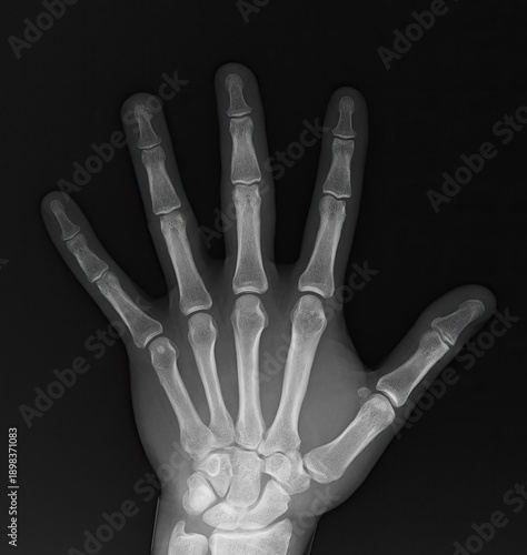 x ray image of human hand