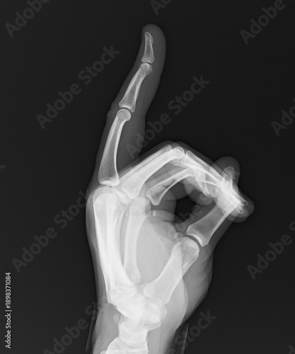x ray image of human hand
