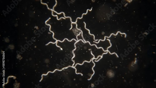 Ultra-realistic microscopic video of the spirochete Borrelia burgdorferi under a high-end laboratory microscope in darkfield viewing. The thin, corkscrew-like bacteria have a characteristic spiral mor