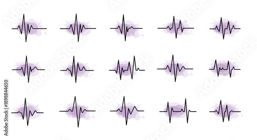 Multiple purple heart rate monitor lines displaying rhythm patterns