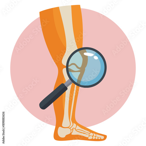 Knee pain medical icon in flat vector style joint disease body doctor concept perfect for healthcare treatment diagnosis therapy and orthopedic design applications