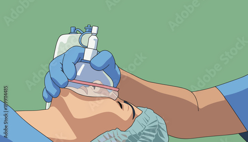 a vector, Anesthesiologist making ingalation anesthesia for patient. Doctor puts a mask on the patient before starting operation