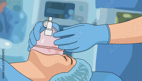 a vector, Anesthesiologist making ingalation anesthesia for patient. Doctor puts a mask on the patient before starting operation