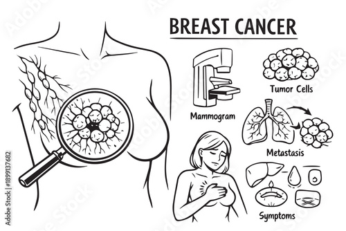 A health education themed vector explains breast cancer visually, highlighting prevention, early signs, and awareness to support understanding, empathy, and informed health decisions.