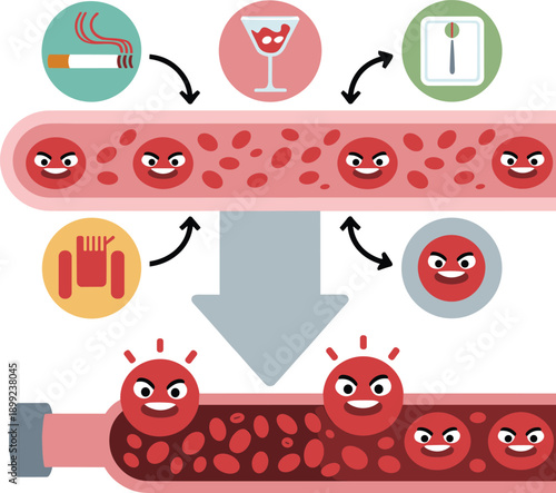 Illustration of high blood pressure causes including smoking, alcohol, obesity, and stress affecting red blood cells in a human artery