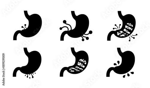 Human Stomach Digestion Conditions Vector Set in Flat Medical Illustration Style