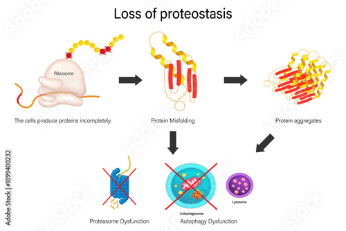 Loss of proteostasis. The loss of balance between protein synthesis, folding, and degradation. Hallmarks of aging.