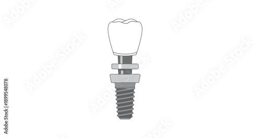 Detailed illustration of a dental implant with abutment and screw on a plain background