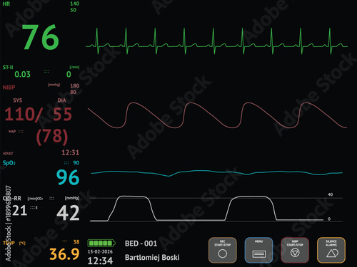 Hospital health bedside monitor. Professional medical hospital screen for monitoring heart rate, oxygen and other vital parameters. Realistic bedside UI template with medical data.