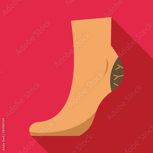 Leg showing varicose veins on ankle indicating a medical condition