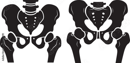 Black and White Vector Illustrations of Human Pelvis Anatomy Side-by-Side Comparison