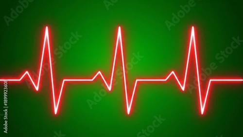 Heartbeat line on electrocardiogram monitor screen with green background