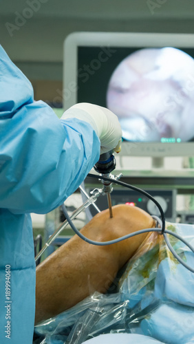 Orthopedic surgeon performing knee arthroscopy surgery using endoscopic instruments in a modern operating room.