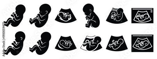 Minimalist black silhouette icon set of a ultrasound baby . simple black flat vector style for medical and fitness icons concept.