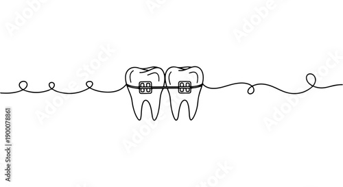 Orthodontic Braces on Teeth Illustration - A Minimalist Single Line Drawing of Dental Correction