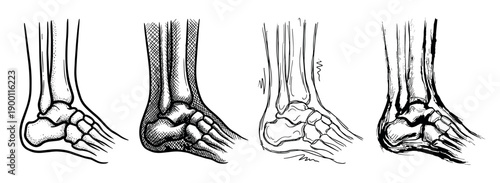 Four anatomical illustrations of the human foot and ankle skeleton presented in a hand-drawn sketch style with various techniques like stippling, cross-hatching, and line art